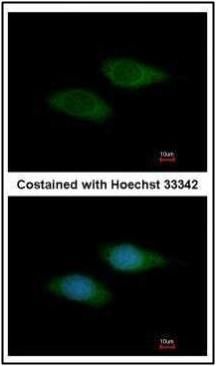 SNTB2 antibody