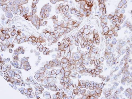 SNTB2 Rabbit Polyclonal Antibody