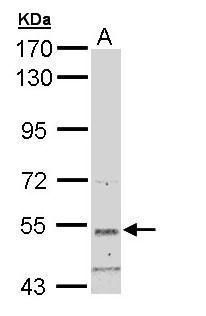 SNTB2 Rabbit Polyclonal Antibody