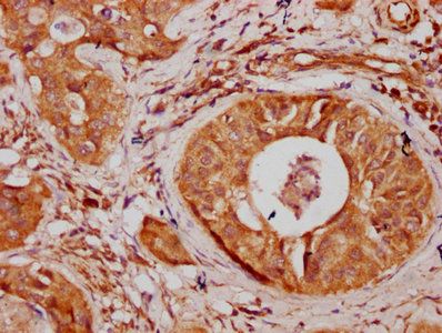 SNX10 Antibody
