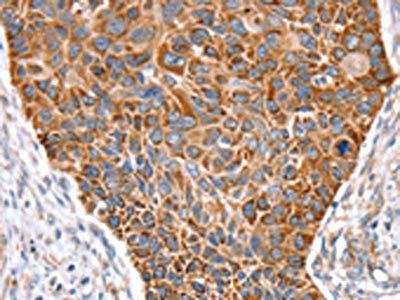 SNX11 Antibody