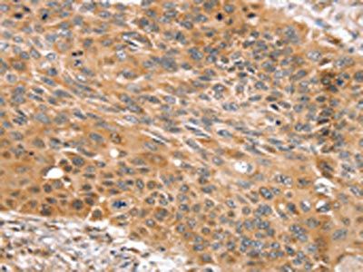 SNX11 Antibody