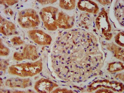 SNX12 Antibody