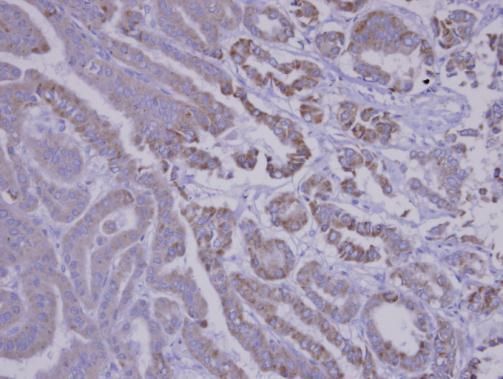 SNX12 Rabbit Polyclonal Antibody