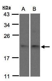 SNX12 Rabbit Polyclonal Antibody