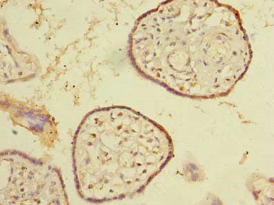 SNX16 antibody