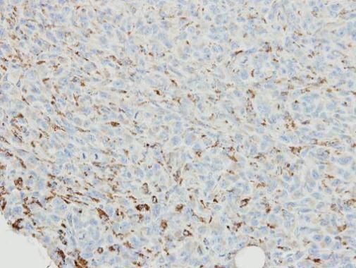 SNX18 antibody [C3], C-term