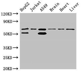 SNX27 Antibody