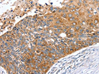 SNX27 Antibody