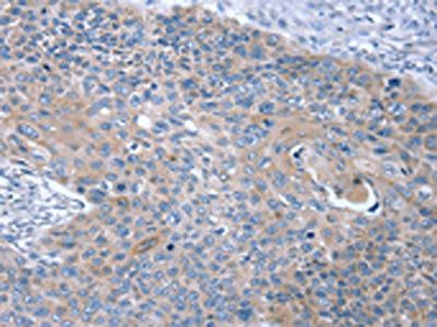 SNX27 Antibody