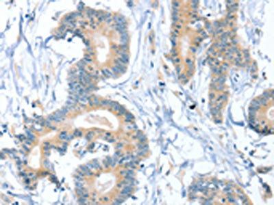 SNX29 antibody