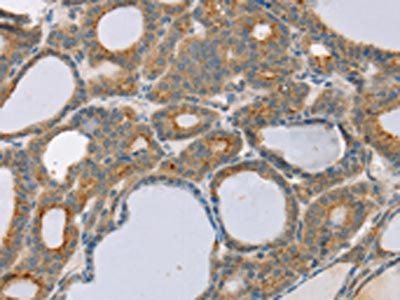 SNX30 Antibody
