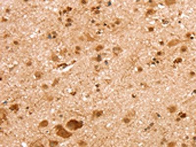 SNX30 Antibody
