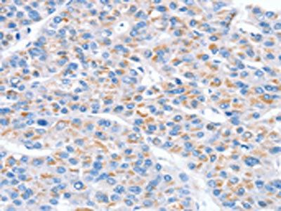 SNX33 antibody