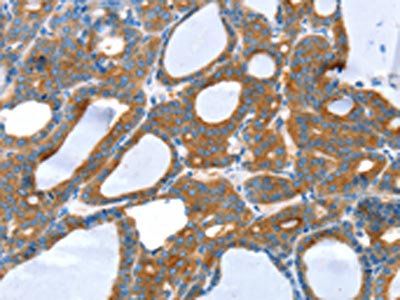 SNX5 Antibody