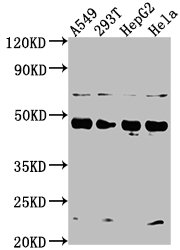 SNX5 Antibody