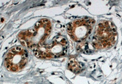 Goat anti-SNX5 Antibody