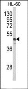 SNX6 antibody