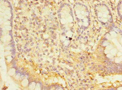 SNX6 Antibody