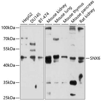 SNX6 antibody