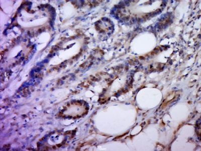 SNX7 Rabbit Polyclonal Antibody