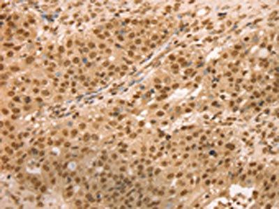 SNX8 Antibody