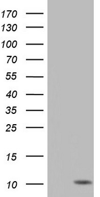 SOAT 2 (SOAT2) antibody
