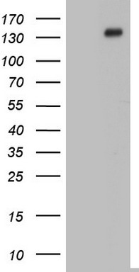 SOAT 2 (SOAT2) antibody