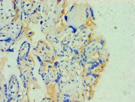 SOAT1 antibody