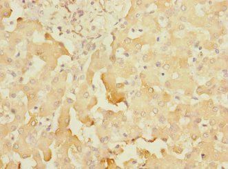 SOAT2 Antibody