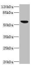 SOAT2 Antibody