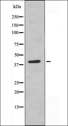 SOCS-1 antibody