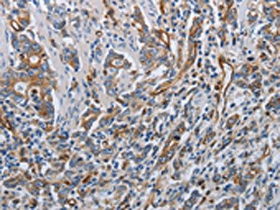 SOCS1 Antibody