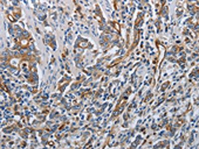 SOCS1 antibody