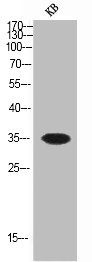 SOCS1 Antibody
