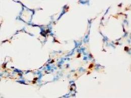 Anti-SOCS1 Antibody