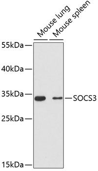 SOCS3 antibody