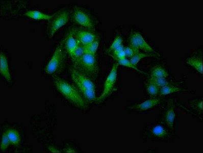 SOCS3 Antibody