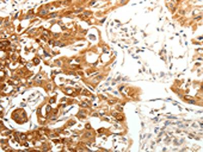 SOCS3 Antibody
