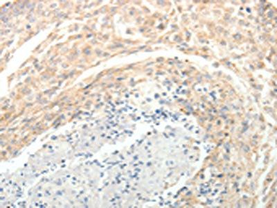 SOCS3 Antibody