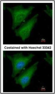 SOCS4 antibody [C3], C-term