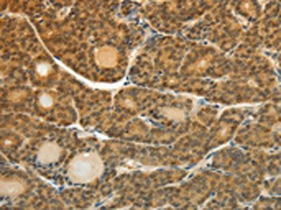 SOCS5 Antibody