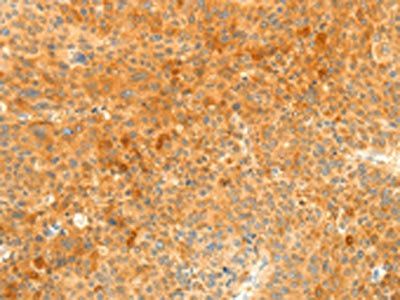SOCS6 Antibody