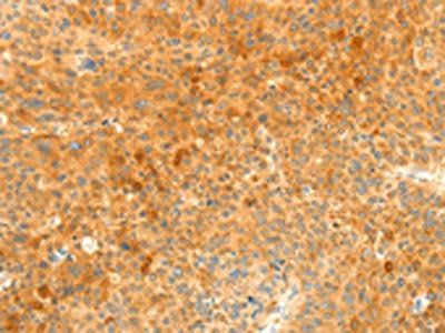 SOCS6 antibody