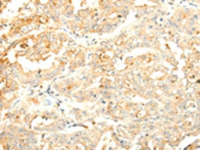 SOCS6 Antibody