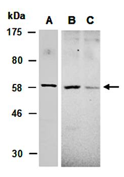 SOCS6 antibody