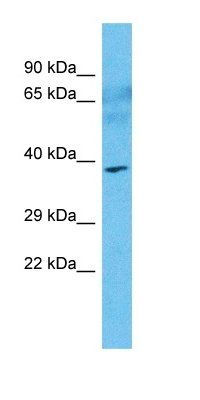 SOCS7 antibody