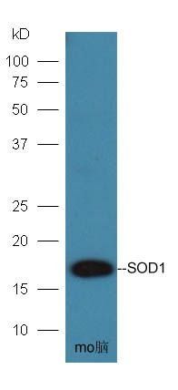 SOD1 antibody