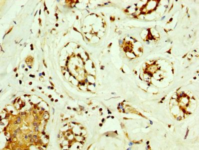 SOD2 Antibody