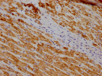 SOD2 Recombinant Monoclonal Antibody